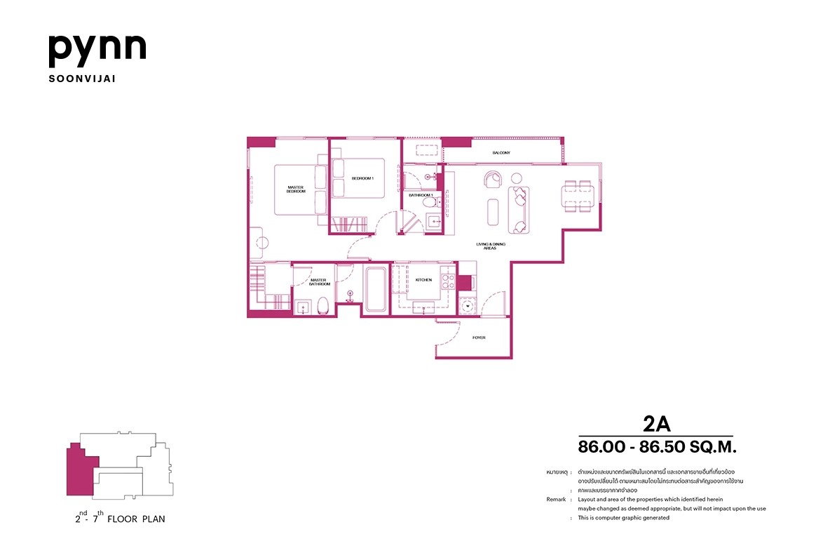 รูปภาพType 2A